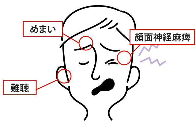 症状の該当箇所のイラスト