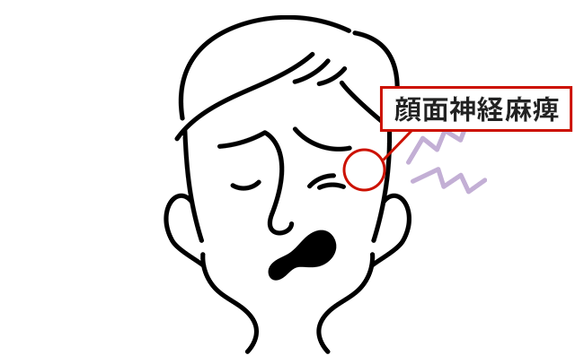 症状の該当箇所のイラスト