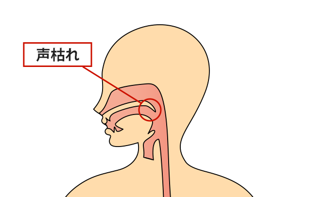 症状の該当箇所のイラスト