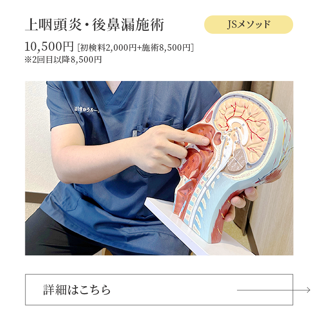 上咽頭炎・後鼻漏施術